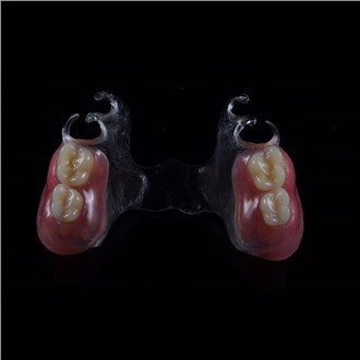 Proteză parțială acrilică detașabilă