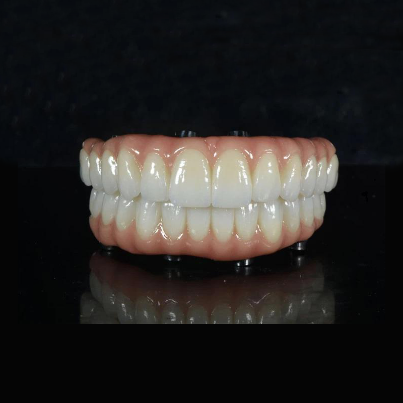 PODUL ALL-ON -X ZIRCONIA