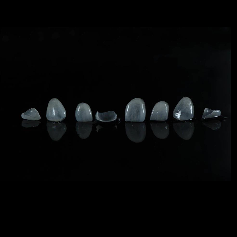 Feldspathic Veneers