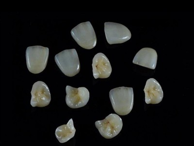 Cum să alegi cel mai bun adeziv dentar pentru coroane: un ghid recent