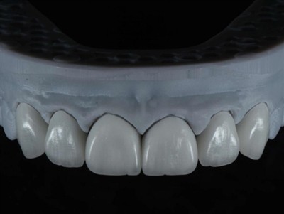 Cum să externalizați munca unui tehnician de laborator dentar în străinătate:...